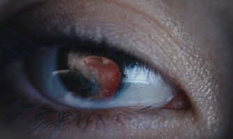 Global: New short film highlights devastating impact less-lethal weapons are having on protesters globally